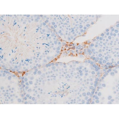 Polyclonal Rabbit anti-Human DNM1 / Dynamin Antibody (phospho-Ser774, IHC, WB)