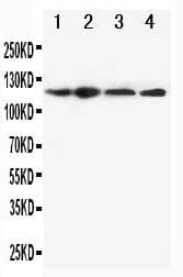 NALP3 / NLRP3 Antibody (aa12-31)