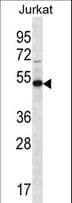 FAM8A1 Antibody (aa87-115)