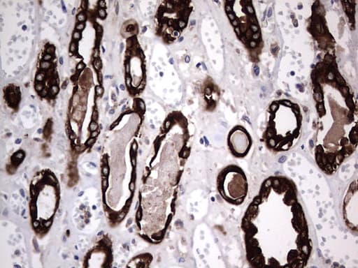 Monoclonal Rat anti-Human Acidic Cytokeratin Antibody (clone 9H3, IHC)