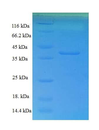 Human CNN3 Protein (Recombinant His)