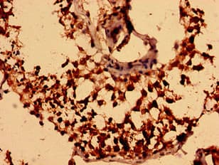 NEGR1 / Neurotractin Antibody