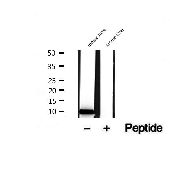 Polyclonal Rabbit anti-Human TIMM9 Antibody (IHC, IF, WB)