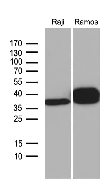 CD79B / CD79 Beta Antibody (clone OTI4E11, Carrier-free)