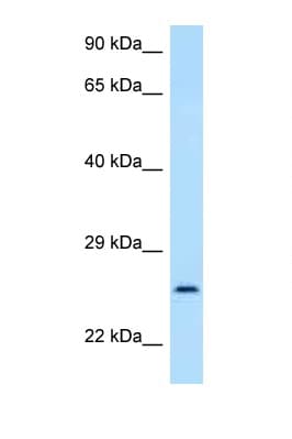 GOSR2 / Membrin Antibody (aa39-88)