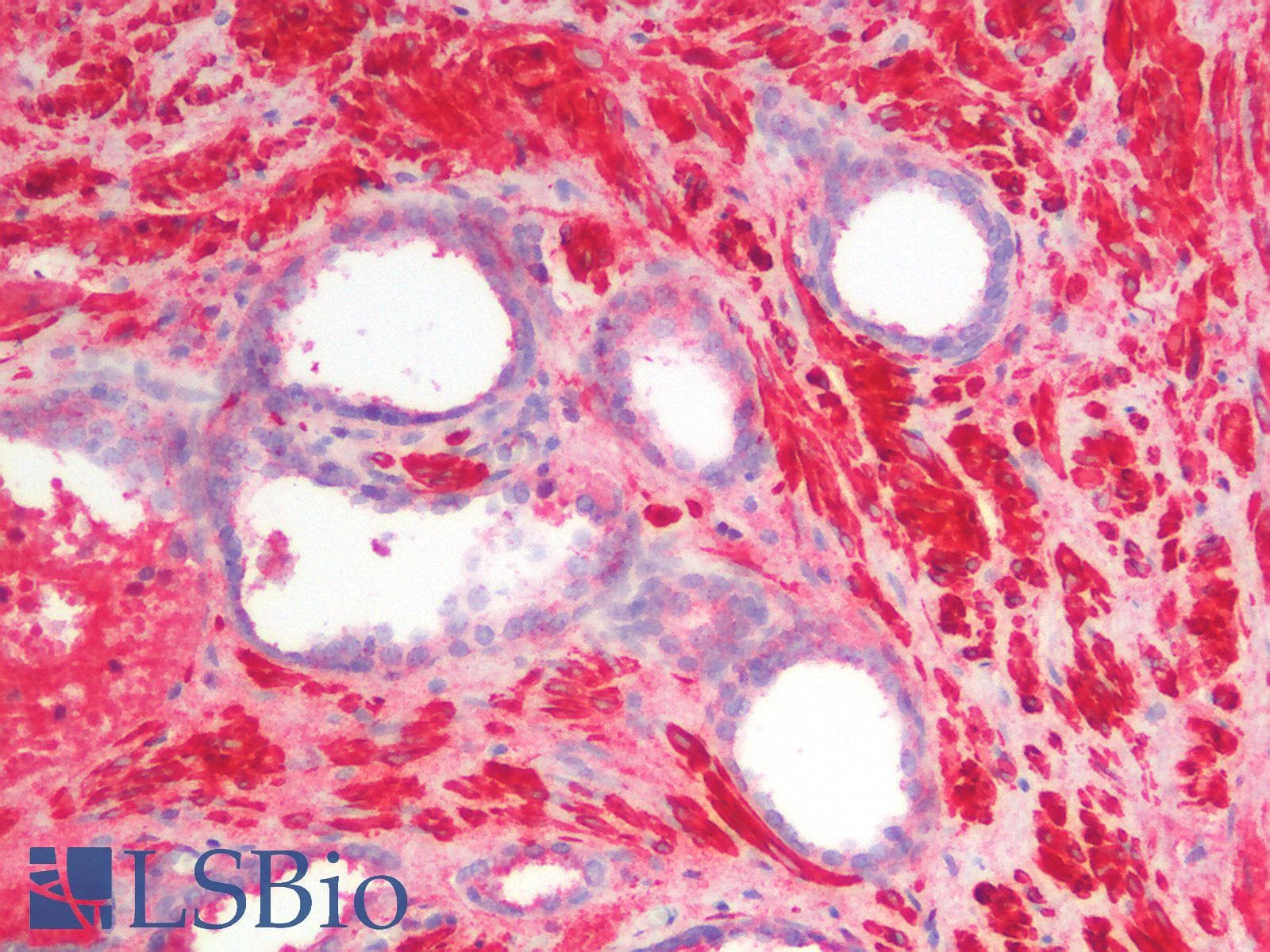 IHC-plus™ Recombinant Monoclonal Mouse anti-Human CALD1 / Caldesmon Antibody (clone rCALD1/820, IHC)