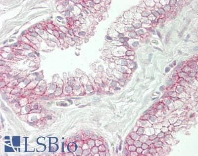 IHC-plus™ Polyclonal Rabbit anti-Human SPTBN2 Antibody (aa2340-2390, IHC, WB)