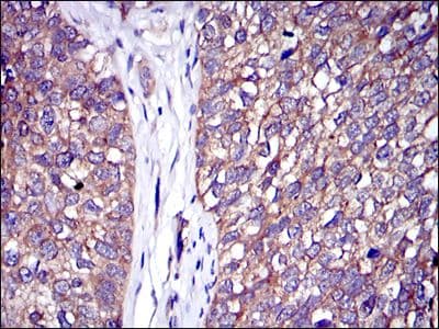 Monoclonal Mouse anti-Human c-CBL Antibody (clone 3B12, IHC, IF, WB)