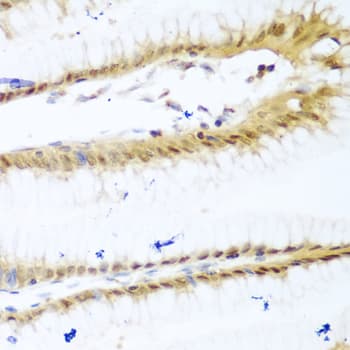 UNG / Uracil DNA Glycosylase Antibody