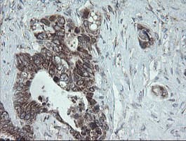 NDUFB10 Antibody (clone OTI1H6)