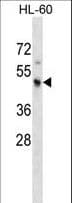 KCNJ3 / GIRK1 Antibody (aa390-418)