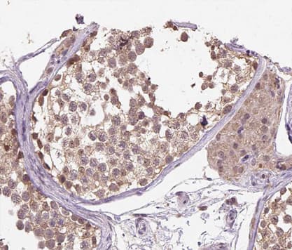 CUL1 / Cullin 1 Antibody
