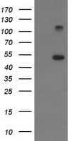 IHC-plus™ Monoclonal Mouse anti-Human TUBB4 / Tubulin Beta 4 Antibody (clone 6C2, IHC, IF, WB)