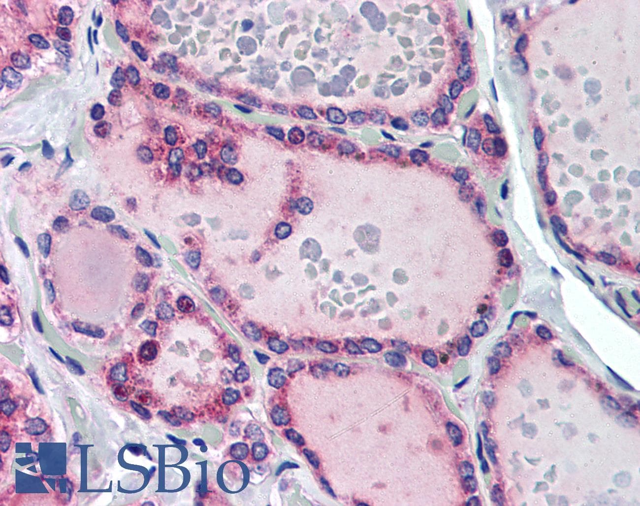 IHC-plus™ TRH Receptor / TRHR Antibody (aa350-400)