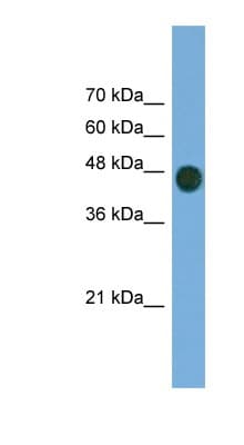 Polyclonal Rabbit anti-Human ARFGAP1 Antibody (aa287-336, WB)