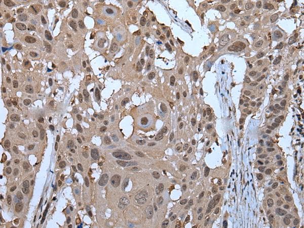 ZNF787 Antibody