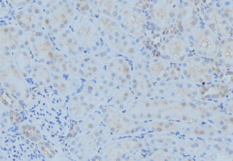 POLG Antibody (aa462-490)
