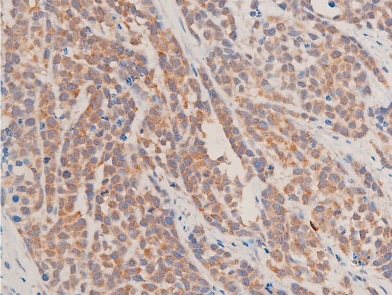 TGFB1 / TGF Beta 1 Antibody