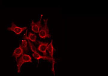 Polyclonal Rabbit anti-Human S100A7L2 Antibody (IF, WB)