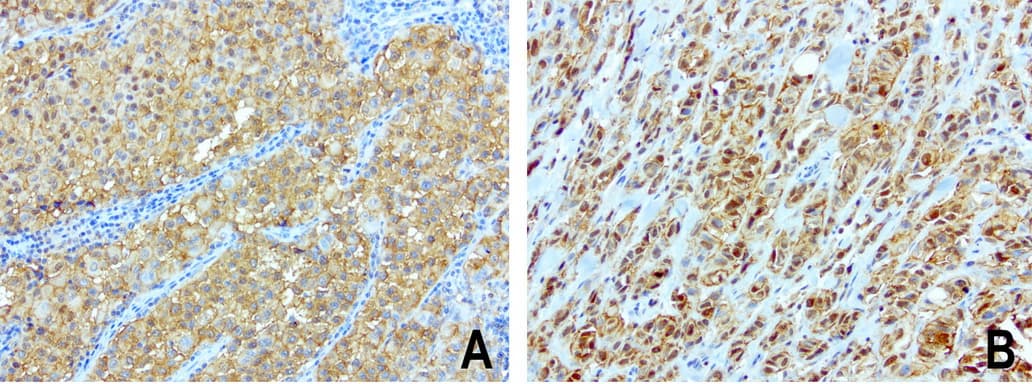 SDCBP / Syntenin Antibody (clone UMAB69, Carrier-free)