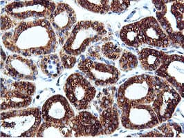ILVBL Antibody (clone OTI8A12)