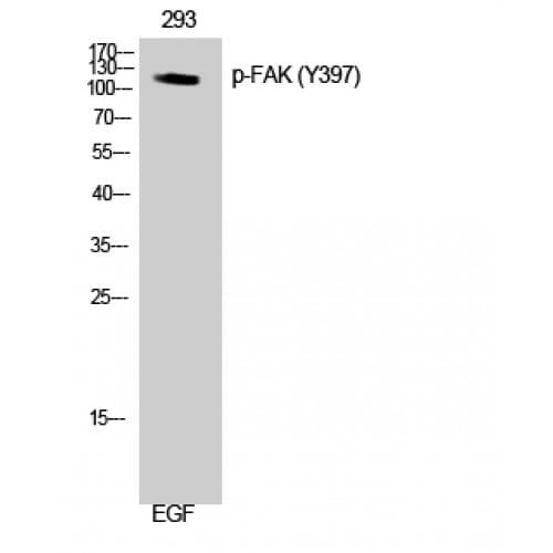FAK / Focal Adhesion Kinase Antibody (340-420 aa)