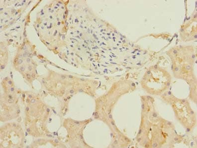 Polyclonal Rabbit anti-Human GHITM Antibody (IHC, WB)