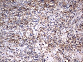 Monoclonal Mouse anti-Human Vimentin Antibody (clone OTI5D7, IHC, WB)