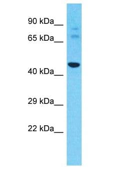 Polyclonal Rabbit anti-Human PRAMEF7 Antibody (aa119-168, WB)