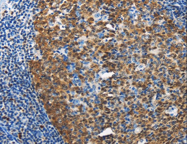 DCK / Deoxycytidine kinase Antibody