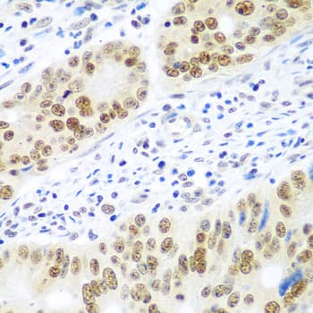Polyclonal Rabbit anti-Human MDC1 Antibody (IHC, WB)