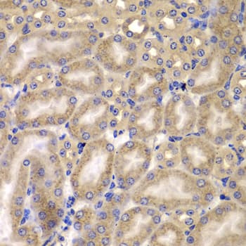 CARD10 / CARMA3 Antibody