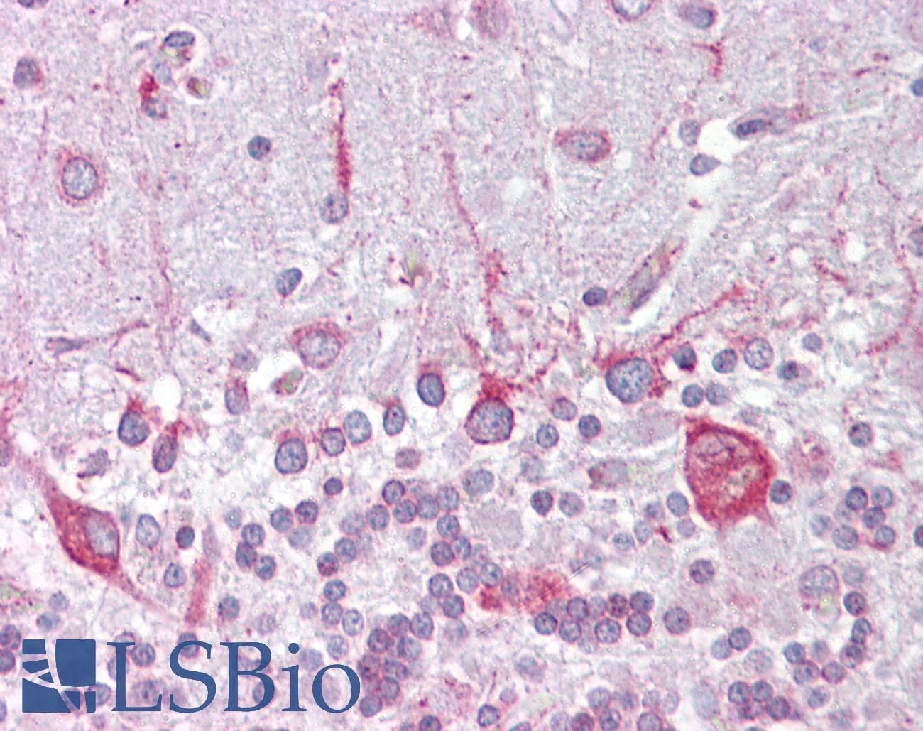 Polyclonal Rabbit anti-Human PSEN1 / Presenilin 1 Antibody (aa107-156, IHC, WB)