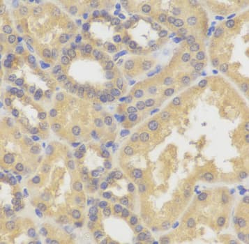 Polyclonal Rabbit anti-Human SMYD5 Antibody (IHC, IF, WB)