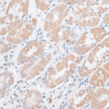 PAEP / Glycodelin / GdF Antibody