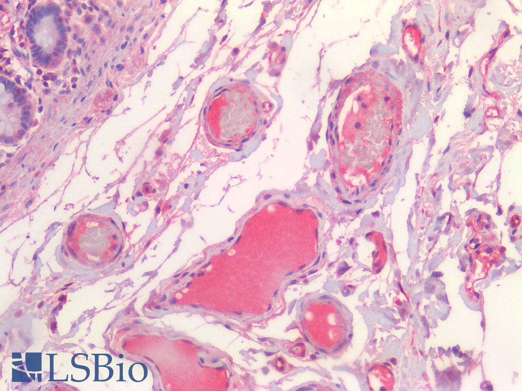PathPlus™ CHAT Antibody (aa70-120)