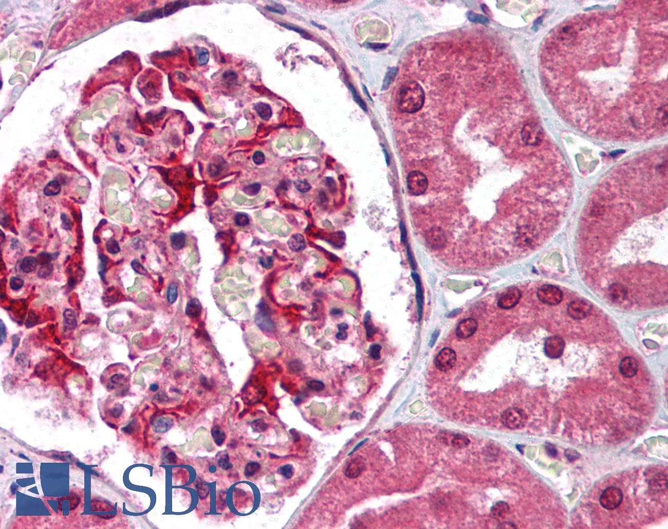 Polyclonal Rabbit anti-Human HDLBP / Vigilin Antibody (N-Terminus, IHC, WB)