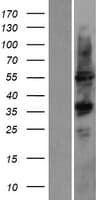 Human CYP2D6 Protein (Over-Expression Lysate Myc-DDK (Flag))