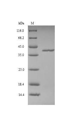 Vaccinia Virus VACWR090 Protein (Recombinant 6His, N-terminus)