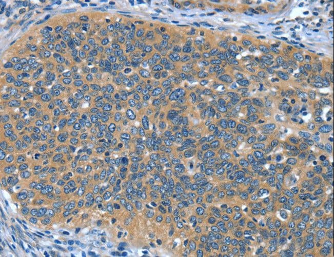 DTX1 / Deltex Antibody