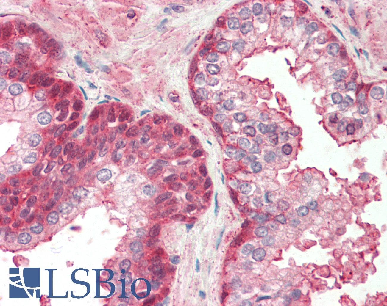 IHC-plus™ RCBTB2 Antibody (aa421-434)