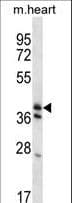 KLF2 Antibody (aa13-42)