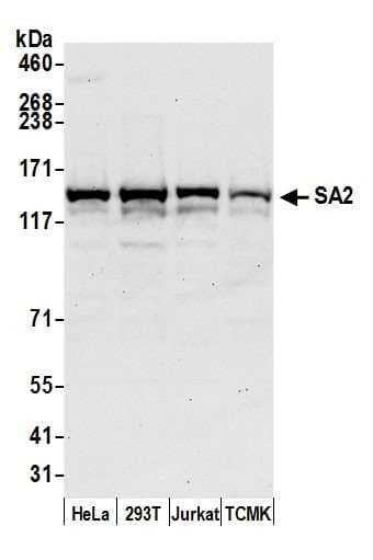 IHC-plus™ Polyclonal Goat anti-Human STAG2 Antibody (aa1100-1150, IHC, WB)