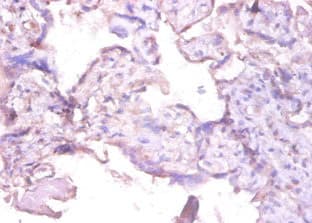 MMP1 Antibody