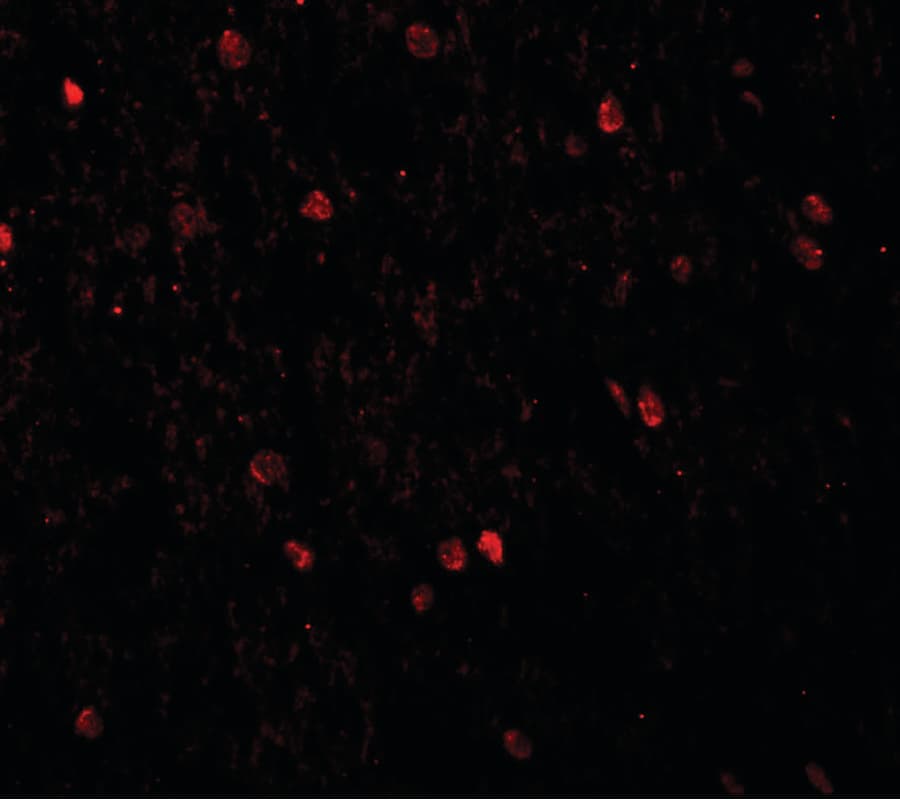 SHANK3 Antibody