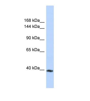 Polyclonal Rabbit anti-Human MYBPC3 / MYBP-C Antibody (aa193-242, WB)