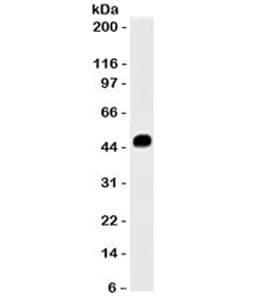 KRT8 / CK8 / Cytokeratin 8 Antibody (clone K8.8)