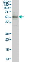 ETV5 / ERM Antibody (clone 3B10)