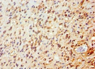 Polyclonal Rabbit anti-Human ARNT2 Antibody (aa440-690, IHC, WB)