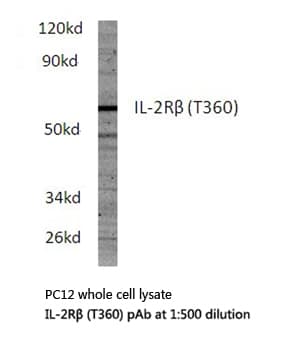 IL2RB / CD122 Antibody (Thr360)